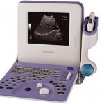 超声波检查-2-阿洛卡 - 日本